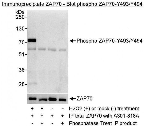 Anti-phospho-ZAP70 (Tyr493/Tyr494)