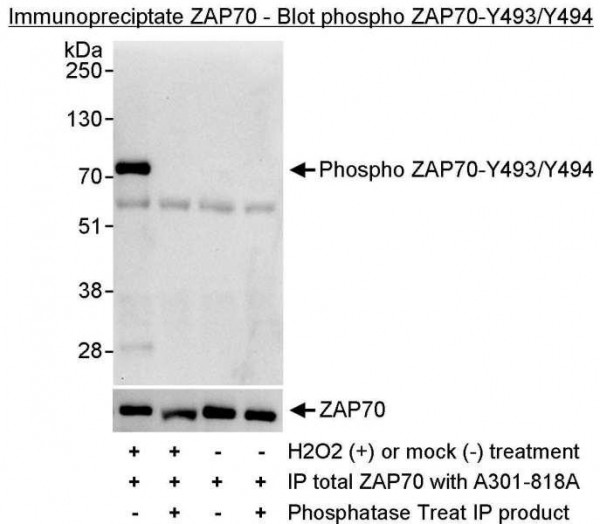 Anti-phospho-ZAP70 (Tyr493/Tyr494)