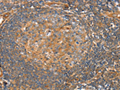 Anti-SRGAP3