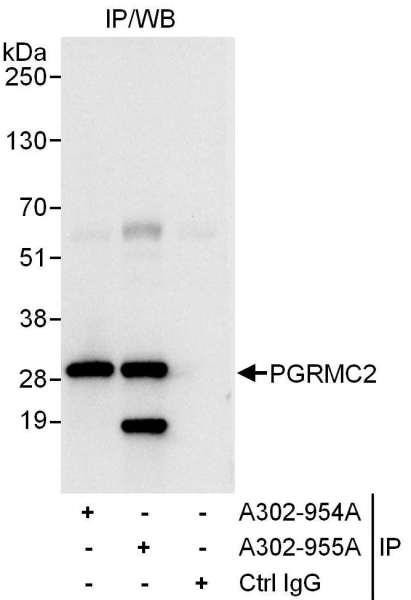 Anti-PGRMC2