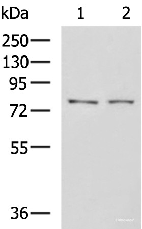 Anti-GPCPD1