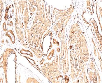 Anti-Alpha Actin / ACTA2 (smooth muscle), clone 1A4