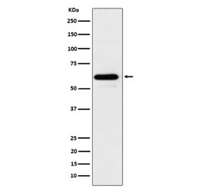 Anti-CDC73 / Cell division cycle protein 73, clone 31C54
