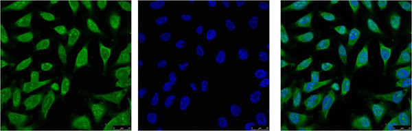 Anti-HSPA1L Monoclonal
