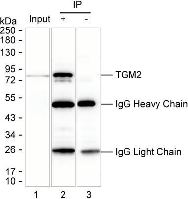 Anti-TGM2