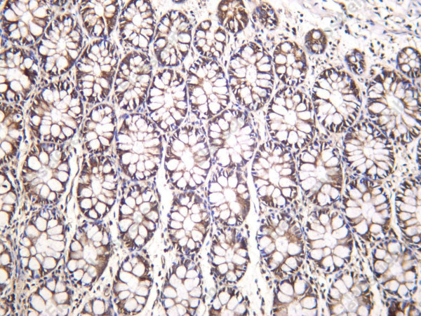 Anti-Recombinant eRF3a, clone C212425