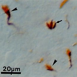 Anti-67 kDa Laminin Receptor, clone 2G13