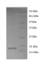 Acyl-CoA-binding protein (DBI), human, recombinant