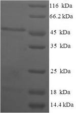 Estradiol 17-beta-dehydrogenase 11 (HSD17B11), human, recombinant
