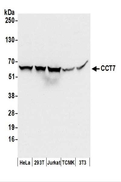 Anti-CCT7