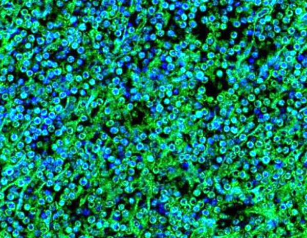 Anti-IL2 Receptor gamma