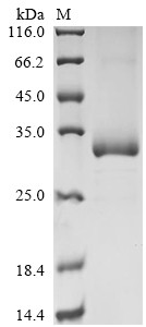 Carbonic anhydrase 5A, mitochondrial (CA5A), human, recombinant