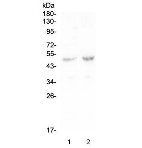 Anti-PLA2G7 / Lp-PLA2 / PAFAH