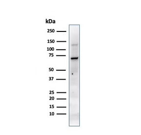 Anti-Placental Alkaline Phosphatase / ALPP / PLAP, clone PL8-F6