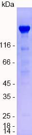 IgE (human), recombinant protein