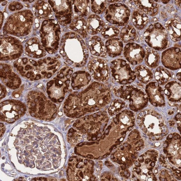 Anti-ATP5S