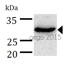 Anti-CA2