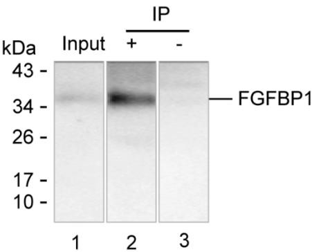 Anti-FGFBP1