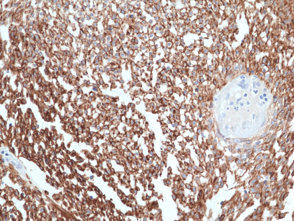 Anti-ANO1 [TMEM16A] (human), Rabbit Monoclonal (RM440)