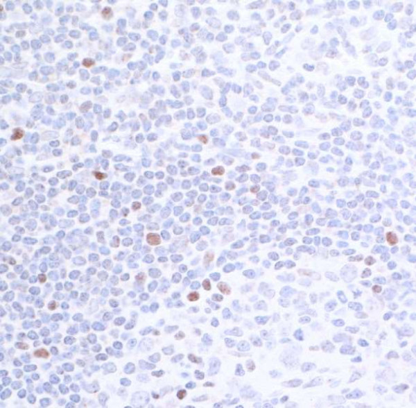 Anti-c-Maf Recombinant Monoclonal