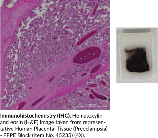 Human Placental Tissue (Preeclampsia) - FFPE Block
