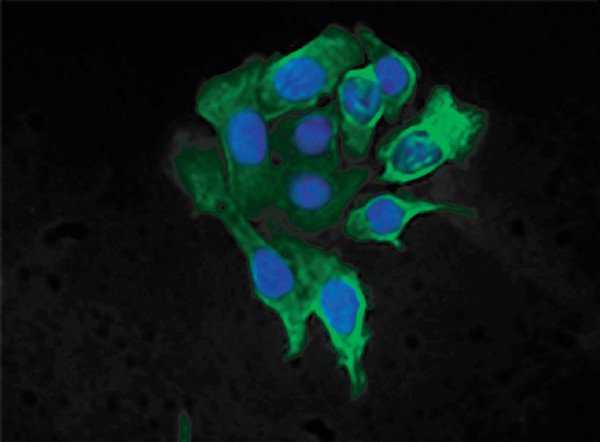 Anti-Cytokeratin 8 (FITC), clone SB37b