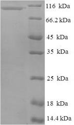 Nucleolar GTP-binding protein 2 (GNL2), human, recombinant