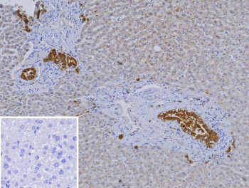 Anti-HNF1B / Hepatocyte nuclear factor 1 beta, clone HNF1B/9518