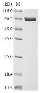 Phytosulfokine receptor 1 (PSKR), partial, Daucus carota, recombinant