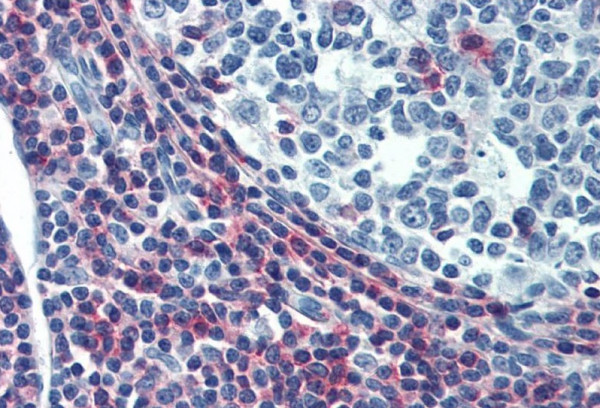 Anti-CD50 / ICAM3 (low endotoxin), clone MEM-04