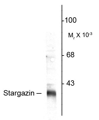 Anti-Stargazin