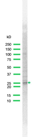 Anti-LMO2, clone SP51