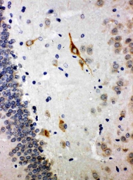 Anti-Somatostatin