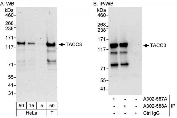 Anti-TACC3