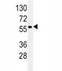 Anti-GCET1 / SERPINA9, clone 136CT29.7.4