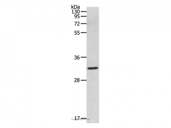 Anti-MMP26