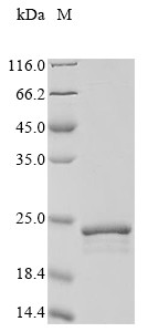 Bacteriorhodopsin (bop), partial, Halobacterium halobium, recombinant
