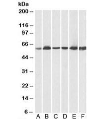 Anti-HSP60