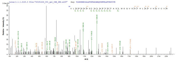 Non-receptor tyrosine-protein kinase TYK2 (TYK2), partial, human, recombinant