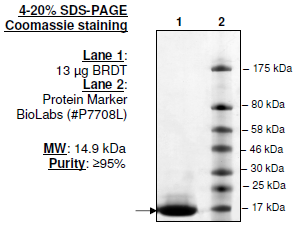 BRDT (22-138), His-tag, human recombinant protein