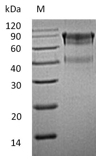 Interleukin-15 receptor subunit alpha (Il15ra), partial (Active), mouse, recombinant