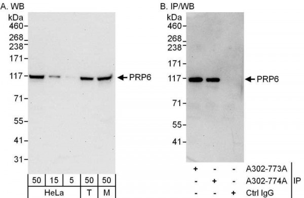 Anti-PRP6