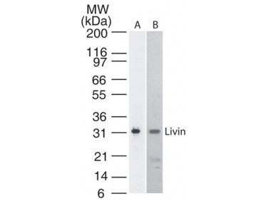 Anti-Livin, clone 88C570
