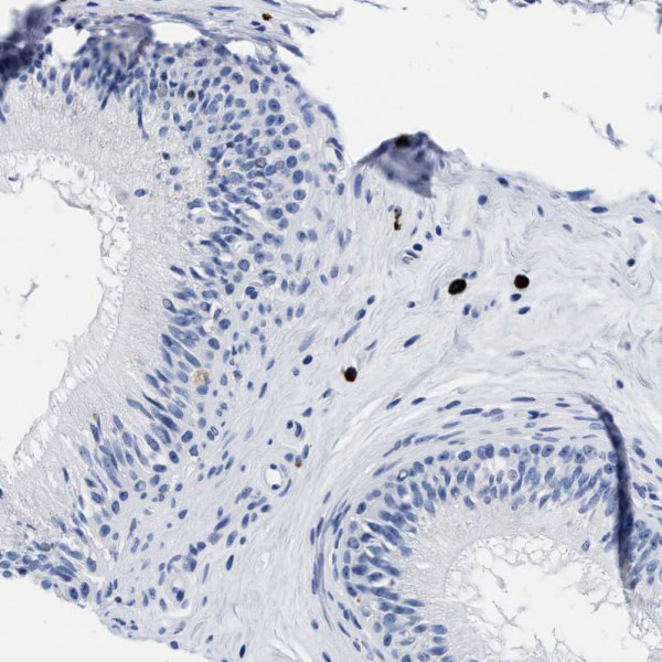 Anti-CER1