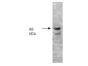 Anti-ALKALINE PHOSPHATASE (Human Intestine)