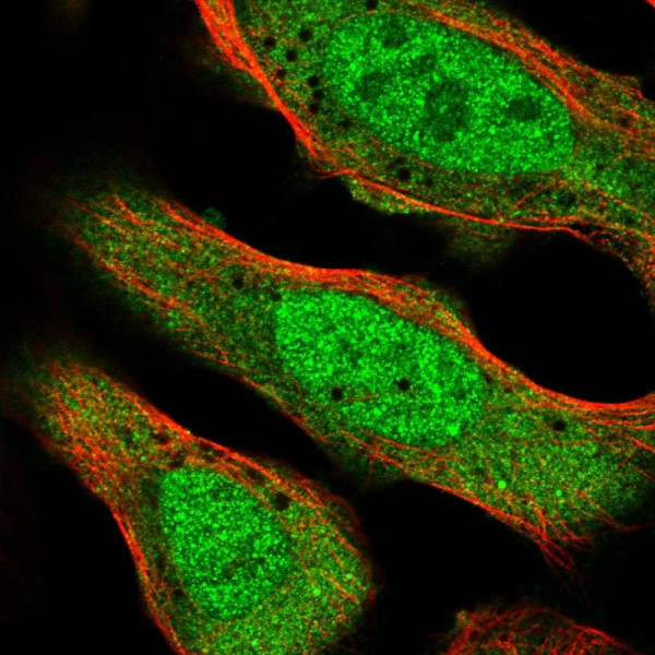 Anti-CNOT2