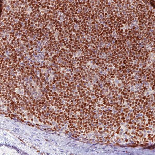 Anti-SOX11 clone CL0143