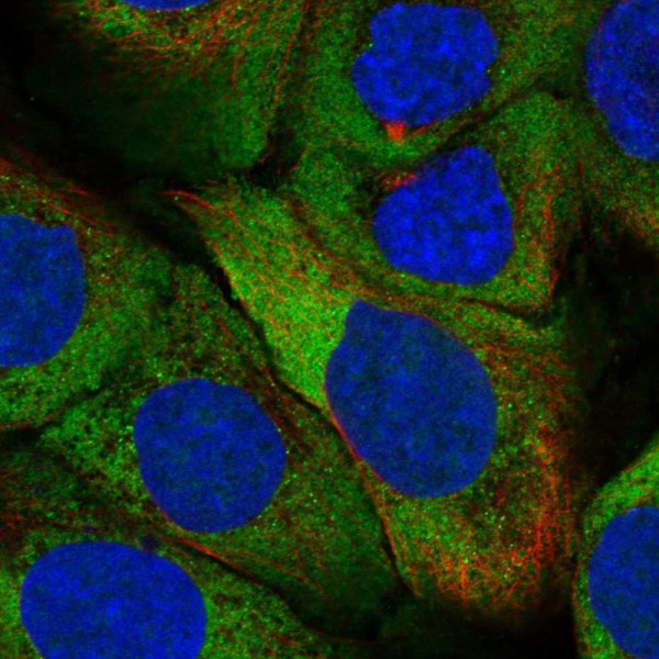 Anti-ZNF385A