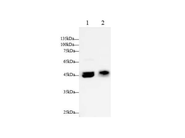 Anti-GLalpha/Galactosidase Alpha