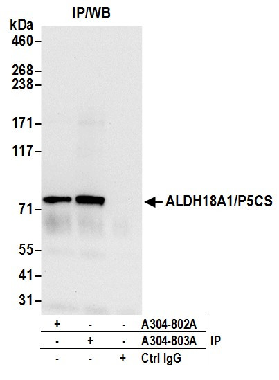 Anti-ALDH18A1/P5CS